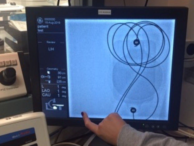 TZ Medical - Pediatric Defibrillation Electrodes